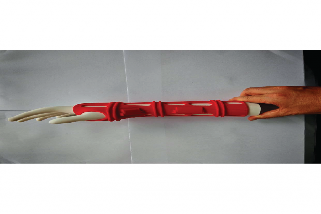 DyanFix 3D Smart Orthopedic Splint